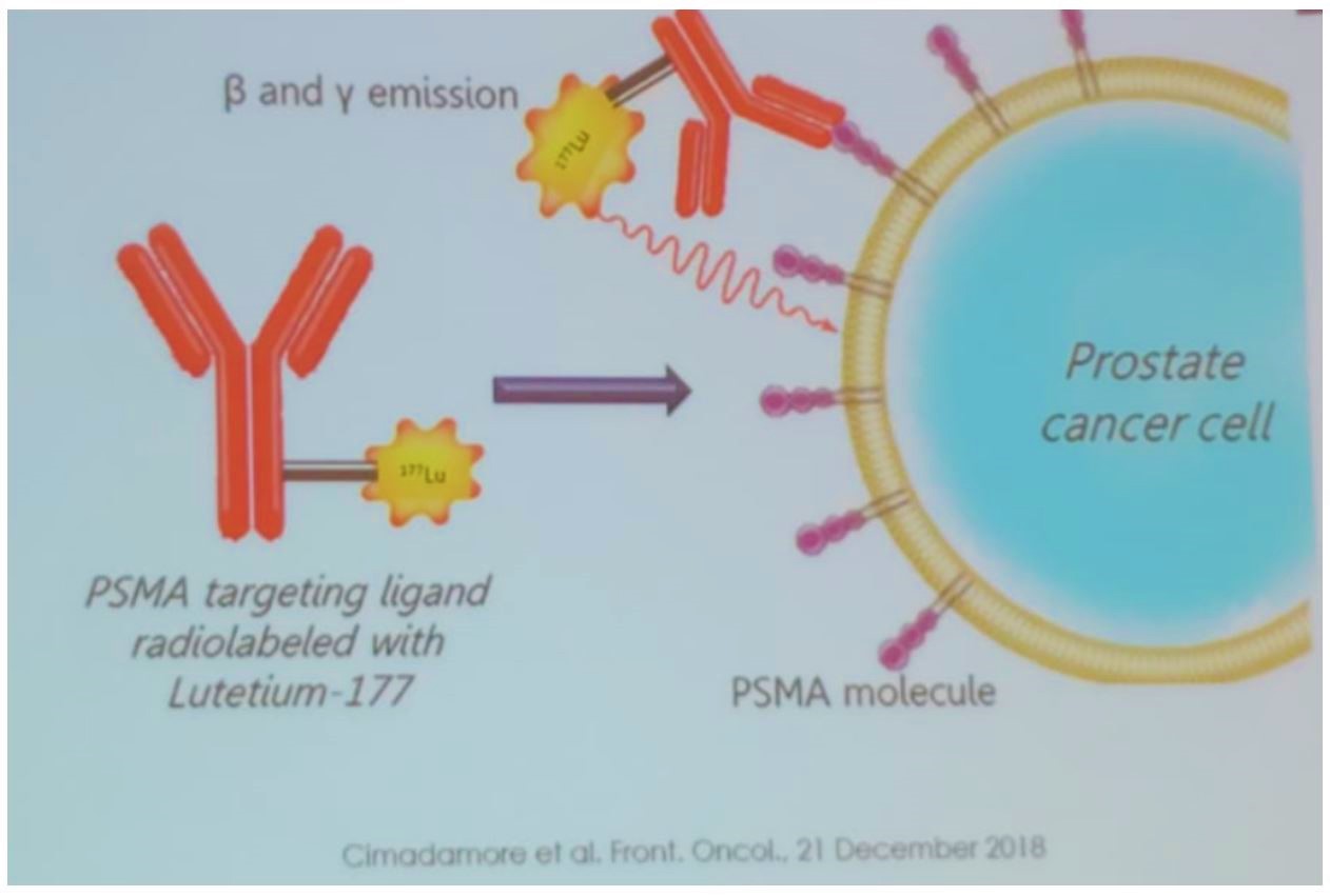 SIU 2019 Theranostic LU PSMA PET